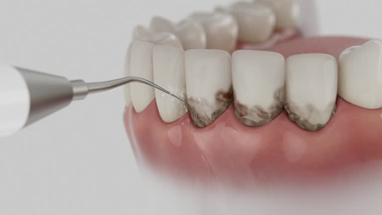 Trusted Wisdom Tooth Removal service in Eatons Neck, NY - Dentist Open Now